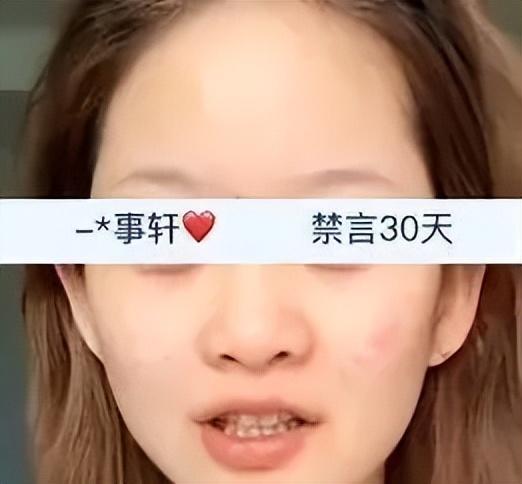 浙江女子一头撞上店家玻璃门，两颗门牙直接磕断，店家该不该担责