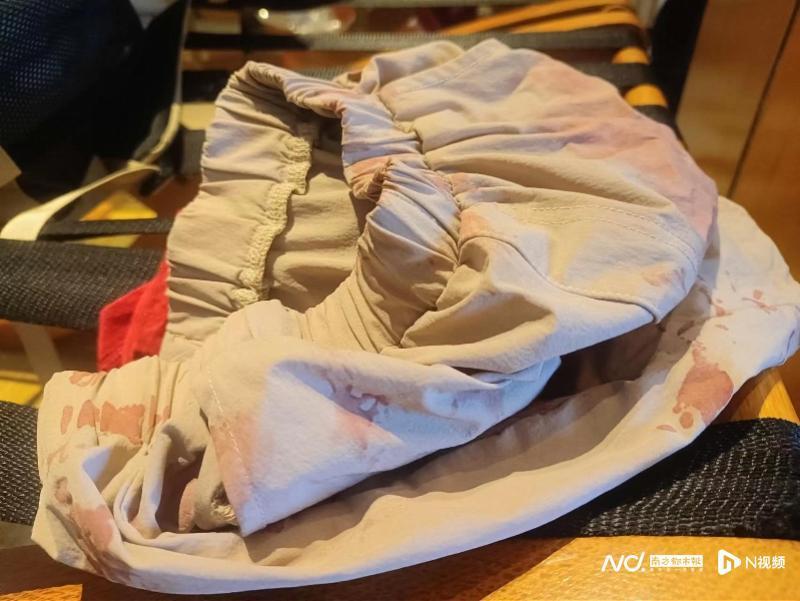 酒店浴室玻璃门爆裂，两男童受伤，浴室玻璃门为何突然爆裂？
